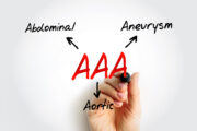 Obstruktive Schlafapnoe: Erhöhtes Risiko für abdominale Aortenaneurysmen
