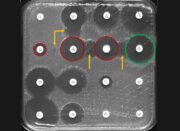 Künstliche Intelligenz hilft bei der Erkennung antibiotikaresistenter Bakterien