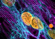 Stabilisierung des Zytoskeletts verbessert Herzfunktion bei hypertropher Kardiomyopathie