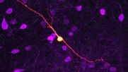 Forschern gelingt neuronale Reprogrammierung in vivo