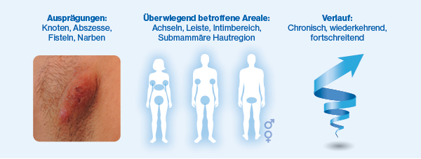 Ausprägungen, Überwiegend betroffene Areale und Verlauf