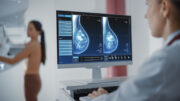 Brustkrebs: Therapieentscheidung auf Basis eines biomarkerbasierten Tests kann auch schädlich sein
