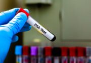 Prostatakrebs: Moderne Diagnostik wichtiger als klassische Tastuntersuchung