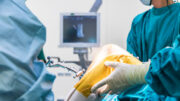 Kniegelenkersatz: Das „vergessene Knie“ ist das Ziel