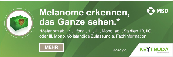 Melanome erkennen, das Ganze sehen*