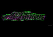 Neue Erkenntnisse zur Herzschwäche: Protein Dysferlin schützt und formt die Membran von Herzmuskelzellen