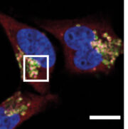 Neuer Mechanismus: Wie Krebszellen dem Immunsystem entwischen