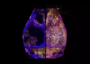 Nature-Studie: Knochenmark im Schädel wächst ein Leben lang