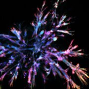 Bauchspeicheldrüsenkrebs: Organoide bilden erstmals die komplexe Zelllandschaft ab