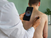 SkinDoc: Erklärbare KI für die Teledermatologie