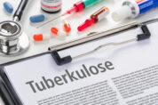 Tuberkuloseforschung: Neuer effektiver Wirkstoff mit großem Potenzial untersucht