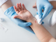 Sonstige Produkte zur Wundbehandlung: Vorläufiger Rapid Report veröffentlicht