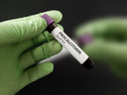 PCT-Test eignet sich nicht, um die Dauer der Antibiotikatherapie zu verkürzen