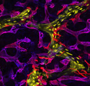 Spezialisierte Blutgefäße: Verborgene Architekten des Knochenumbaus