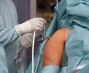 Modernster Standard bei arthroskopischen OPs nur gegen Zuzahlung – Fiktion oder bald Wirklichkeit?