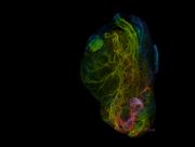 Bauchspeicheldrüsenkrebs: Nerven-Blockade als mögliche neue Behandlungsstrategie