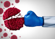 Bauchspeicheldrüsenkrebs: Immunkarte liefert Hinweise für gezielte Behandlung