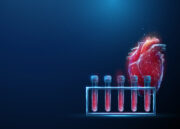 Nicht alle Herzmuskelentzündungen sind gleich