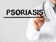 Psoriasis: Entzündungshemmende Wirkung durch lichtaktiviertes Medikament
