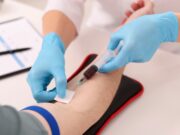 Seltene Erythrodermie mittels Immunphänotypisierung diagnostiziert