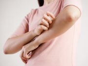 Warum man einen juckenden Hautausschlag nicht aufkratzen sollte