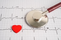 Stethoscope on electrocardiogram ECG, heart wave, heart attack, cardiogram report.