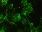 Laborergebnisse stützen den Ansatz, Alzheimer durch Eindämmung von Entzündungsprozessen zu behandeln