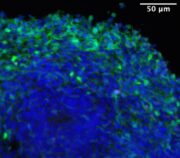 Stress verändert neuronales Gleichgewicht bei der Gehirnentwicklung