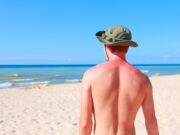 Hautkrebsrisiko in den USA: Umfrage offenbart mangelndes Gewahrsein