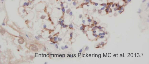 Entnommen aus Pickering MC et al. 2013.9