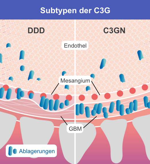 Subtypen der C3G