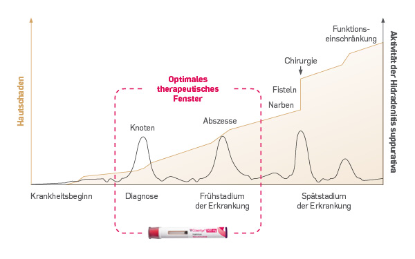 Optimales therapeutisches Fenster