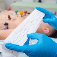 Heart cardiogram in the hands of a doctor close-up. Cardiologist is studying the testimony of an electrocardiograph. Cardiogram tape.