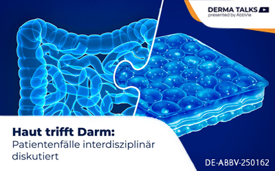 ABDE-0038-0003_21-abbvie-dermatalks-neu_400x250_V1.3