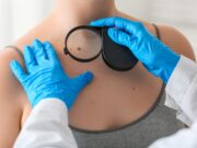 Melanom: Schlüsselrolle des Enzyms HPGDS bei Immuntherapie-Resistenz