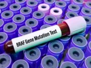 Melanomtherapie: Überwindung von Resistenzen mit GSK3β