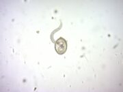 Parkeingänge können Hotspots für infektiöse Hundespulwurmeier sein