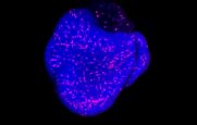 Wie ein rosa leuchtender Himmel: Neues Gehirn-Organoid-Modell vorgestellt