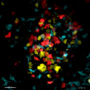 Neue Phase der Immunantwort entdeckt