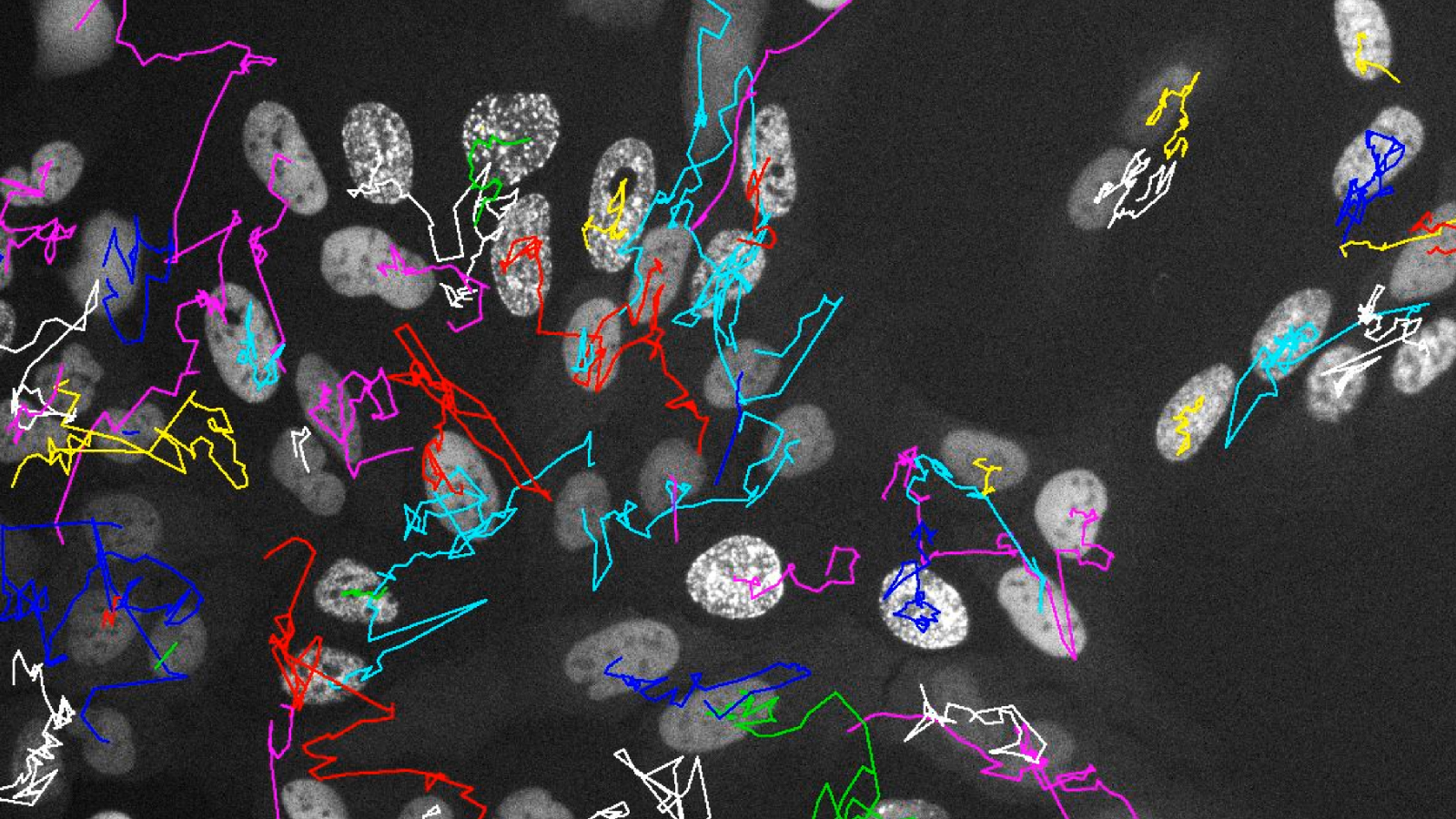 Live verfolgt: Wie Stress Krebszellen über Generationen verändert