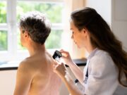 Melanom: Neuer Ansatz verbessert Therapie mit MEK-Inhibitoren