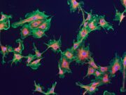 Fibroblasten: Neue Perspektiven für die Wundheilung