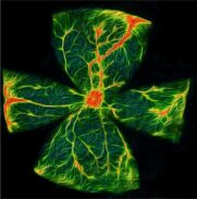 Diabetische Retinopathie: Ein niedriger Blutzucker trägt zu Augenschäden und Sehkraftverlust bei