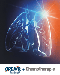 Opdivo+Ctx_Banner_Glaslunge_200x250px