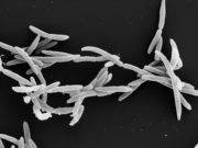 Unerwarteter Bakterienstopper: Grundlage für die Entwicklung von Antisense-Therapeutika gegen Fusobacterium nucleatum gefunden