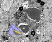 Überlebenstrick: Salmonellen zapfen Eisenquelle in Immunzellen an