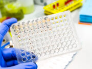 Bessere Qualitätskontrolle bei Allergietherapeutika