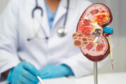 CKD: Neuartiger multiphänotypischer Ansatz zur Erkennung genetischer Faktoren entwickelt
