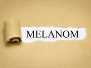 Melanom: Mitochondriale Blockade stoppt Tumorwachstum
