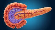 Behandlung von Typ-1-Diabetes: Funktionale Langerhans-Inseln erfolgreich gedruckt